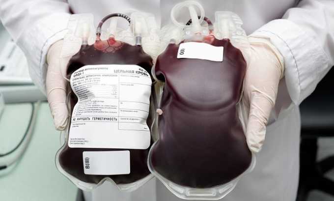 Одним из путей заражения вирусом является гемотрансфузионный (через кровь)