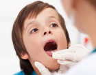Вирусный герпес в горле у ребёнка