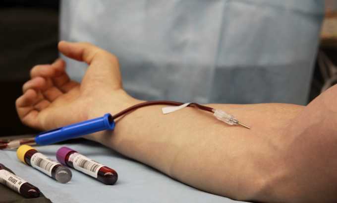 При переливании крови можно заразится герпесом