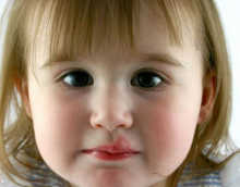 Герпес: лечение простуды на губе у ребенка