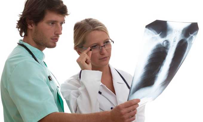 Выполнение рентгенографии легких