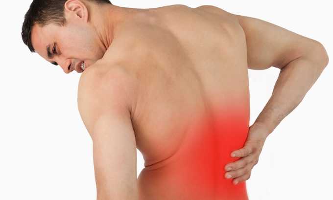 Боль в спине - симптом опоясывающего лишая