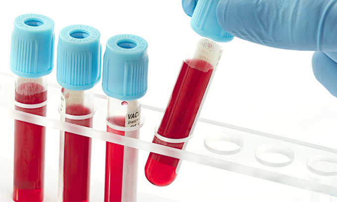 Исследование антител в крови помогает установить тип возбудителя заболевания