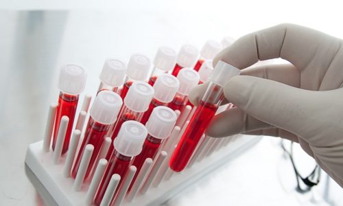 Общий анализ крови необходим для выявления вируса герпеса в организме