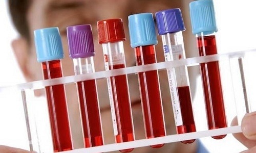 Для более точной диагностики болезни применяют иммуноферментный анализ, который позволяет обнаружить в крови больного специфические антитела