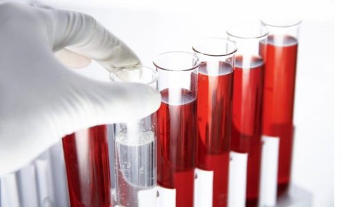 Для постановки диагноза необходимо сдать общие клинические анализы крови