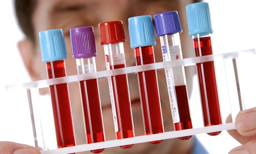 Для выявления заболеваний, вызванных герпесом 8 типа, применяют исследование крови на ВИЧ