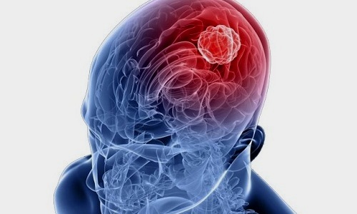 У ослабленных людей и при неправильном лечении герпеса может пострадать головной мозг
